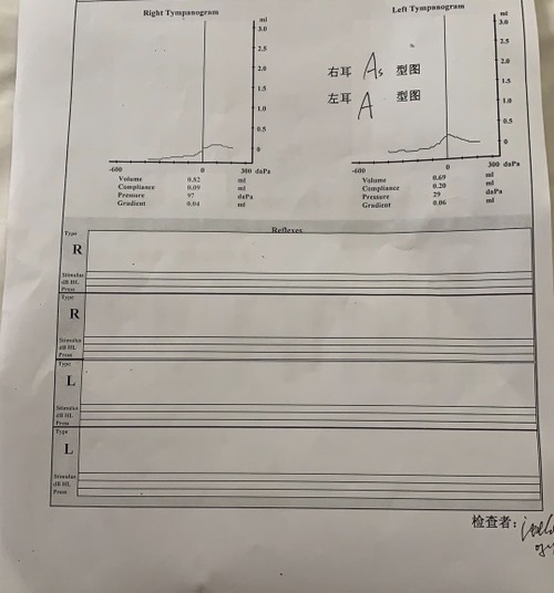 哎！6个月的宝宝貌似听力不正常-惠小助(52huixz.com)