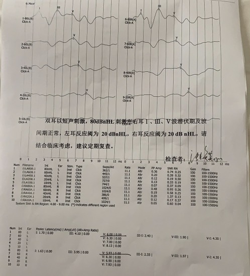 哎！6个月的宝宝貌似听力不正常-惠小助(52huixz.com)