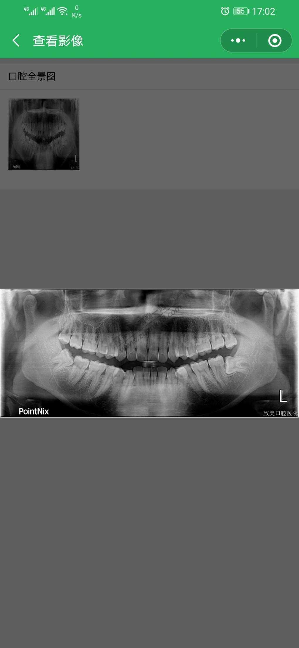 我找到了19年洗牙拍片的智齿了。。。恐怖-惠小助(52huixz.com)
